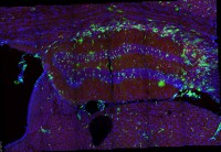 /album/fotogaleria-medium-spiny-neuron-labeled-with-dii-and-genegun/max-stack-jpg/